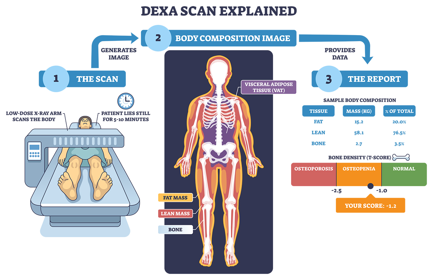 DEXA scan process showing body composition results including fat mass, lean muscle, and bone density measurements